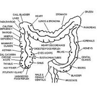 Colon Irrigation