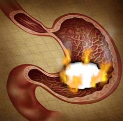 How to Beat Digestive Problems Naturally How to Beat Digestive Problems Naturally