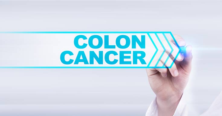 Easy Tips to Reduce Colon Cancer Risk