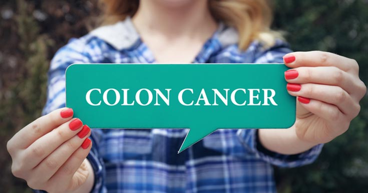 Types of Colon Cancer
