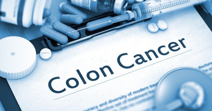 Factors Found to Increase Colorectal Cancer